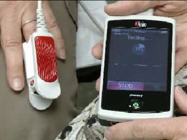 Innovative Anemia Test Requires No Needles Cbs Pittsburgh