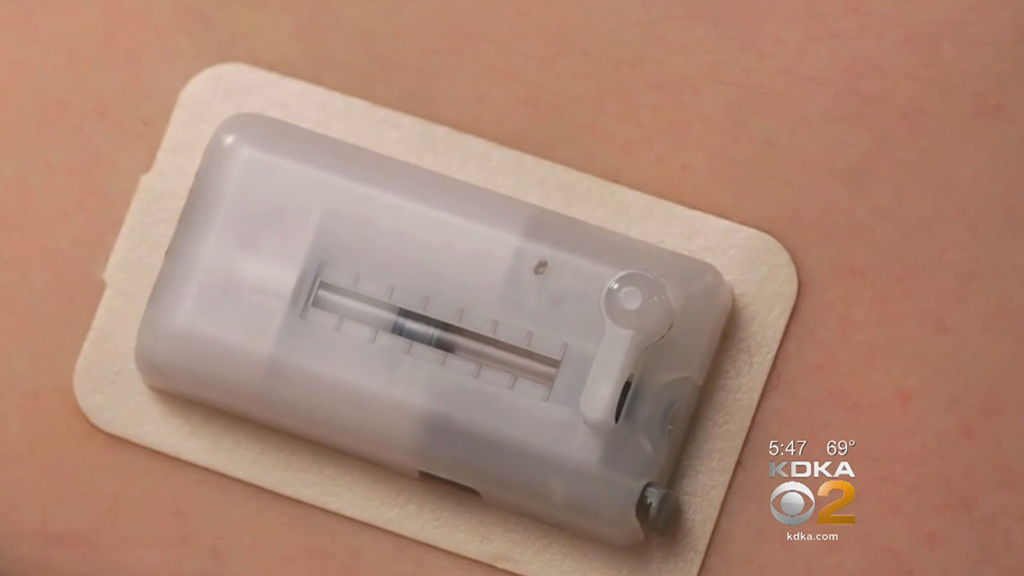 Patch Offers Diabetics Discrete, Easy Option For Insulin Delivery – CBS